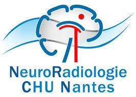 Service de Neuroradiologie interventionnelle et diagnostique du CHU de Nantes